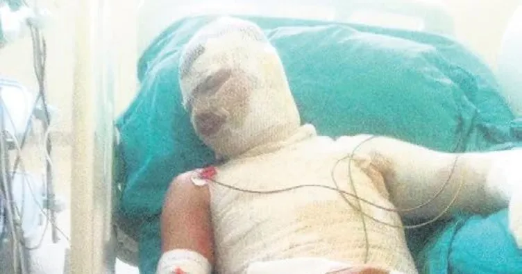 Miras yüzünden yeğenini yaktı