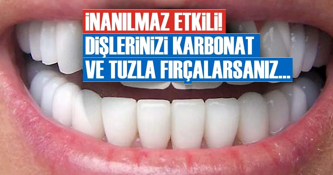 Evde Dis Plagi Temizleme Yollari Saglik Haberleri