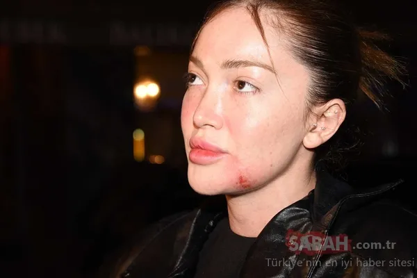 Eski sevgilisi Danla Bilic'e kabusu yaşatmıştı...Şimdi de ölüm tehdidi alıyor - Galeri - Trend Magazin