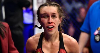Joanna Jedrzejczyk’in son hali şaşırttı!