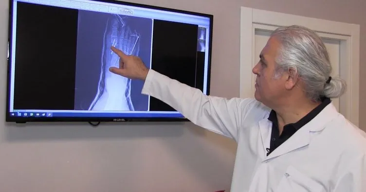 Ortopedi ve Travmatoloji Uzmanı Prof. Dr. Mehmet Arazi: ‘Her 4-5 kişiden birinin ayak parmağında şekil bozukluğu var’