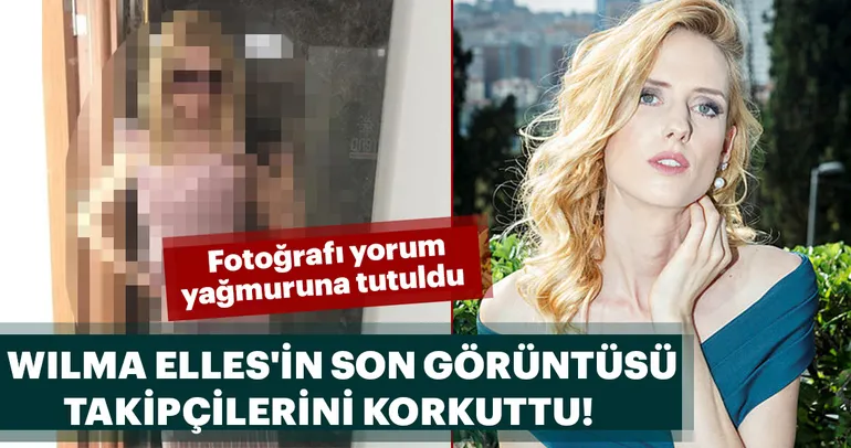 Zayıflayan ünlüler