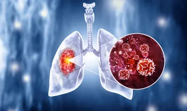 Basit bir ses değişimi demeyin! Akciğer kanserinin ilk belirtisi...