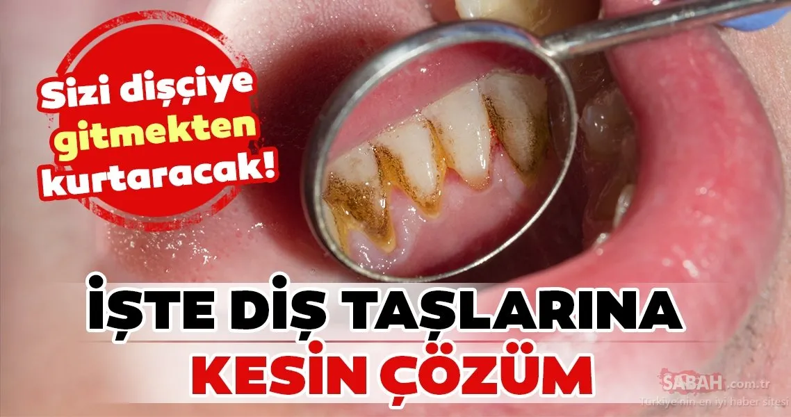 Dislerdeki Siyah Lekeler Neden Olusur Ve Nasil Gecer Mortilki Com