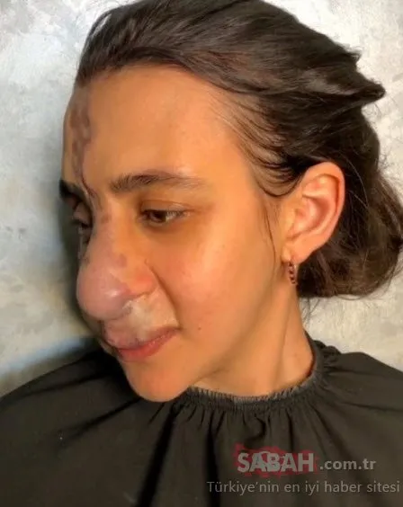 Öyle bir değişti ki....Son haline kendisi bile inanamadı!