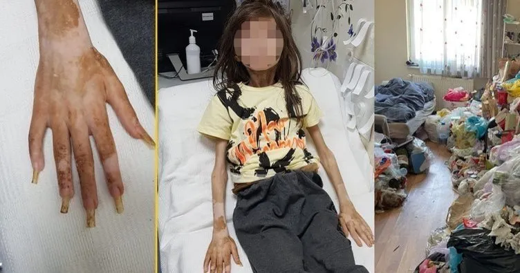 Son dakika: Çöp evde bulunan Cem Muhammet Türkiye'yi derinde sarsmıştı! Cani teyze için o rapor istendi