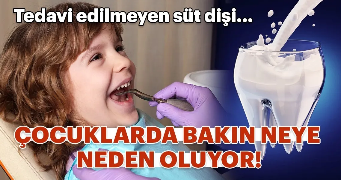 Tedavi Edilmeyen Sut Disi Cocuklarda Bakin Neye Neden Oluyor Kadin Haberleri