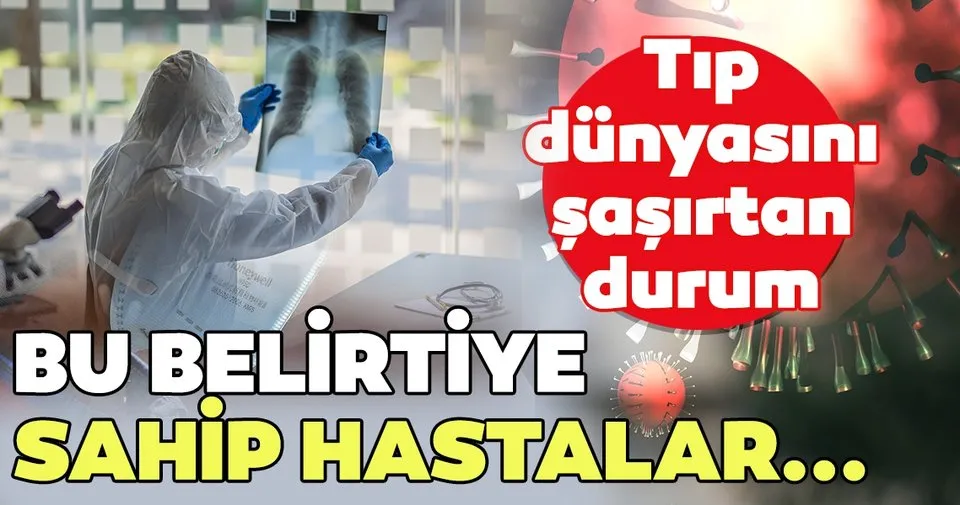 koronavirus ile ilgili sasirtan