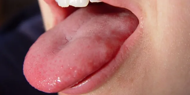 Bu haberi okuduğunuzda dilinize bakacaksınız!