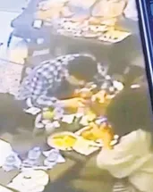 Yemek yerken dudağını böcek ısırdı