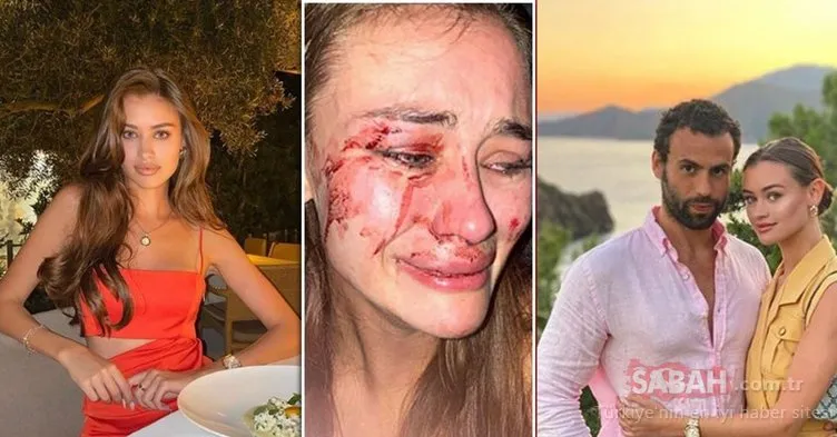 Son dakika haberi: Ünlü Top Model Daria Kyryliuk’un dövüldüğü iddia edilen ’The Beach of Momo’ isimli mekana flaş ceza!