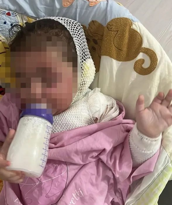Anaokulunda üzerine kahve dökülen 1.5 yaşındaki Aden Aslan’da ikinci derece yanıklar oluştu! Kahrolan anne: Benim evladım acı çekiyor