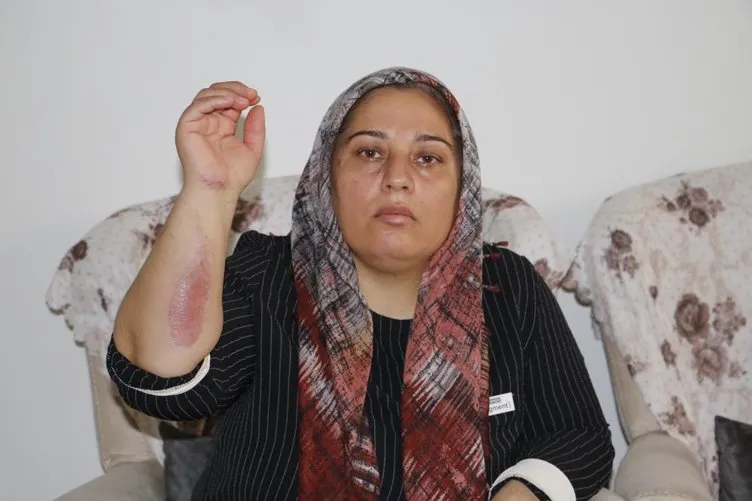 Gaziantep’teki kazadan yaralı olarak kurtulmuştu! Acılı anne detayları tek tek anlattı: Tek elle direksiyonu tutuyordu
