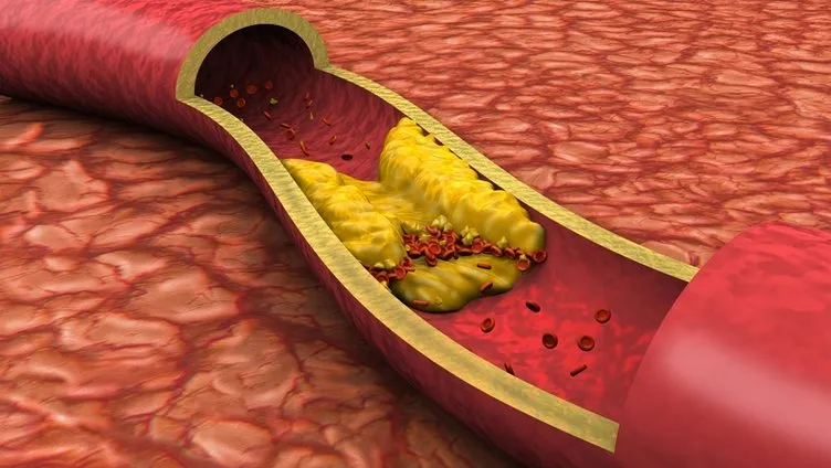 Kötü kolesterol seviyelerini dibe çekiyor! Uzmanlar ’her yemeğe 1 kaşık katın’ diyor