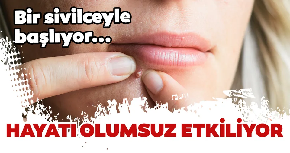 köpek memesi duası