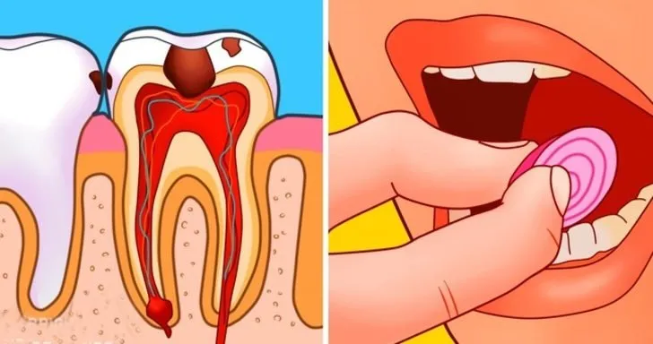 Bu yöntem diş ağrısını anında yok ediyor!