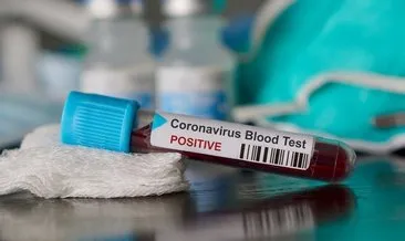 E-Nabız girişi, covid test sonucu sorgulama işlemi: 2021 E-devlet şifresi ile koronavirüs test sonucu e-nabızla nasıl öğrenilir?