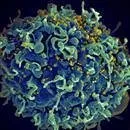 HIV Virüsü keşfedildi
