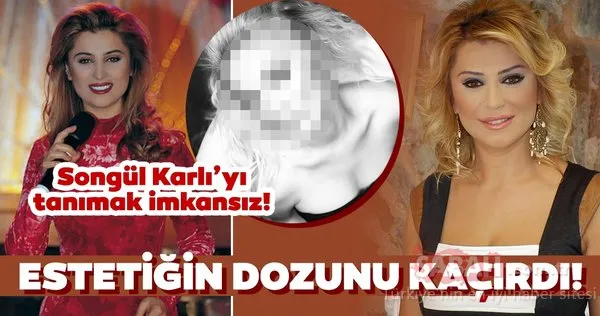 Ünlü şarkıcı Songül Karlı estetiğin dozunu kaçırınca bambaşka biri oldu! İşte hayranlarının tanımakta zorlandığı Songül Karlı...