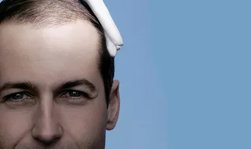 Bu ilaç kelliğe çare oluyor!