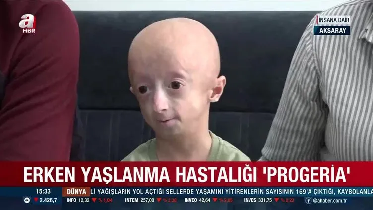 Erken yaşlanma hastalığı 'Progeria'... Türkiye’de sadece 4 kişide var! 1 günü 7 gün olarak yaşıyorlar