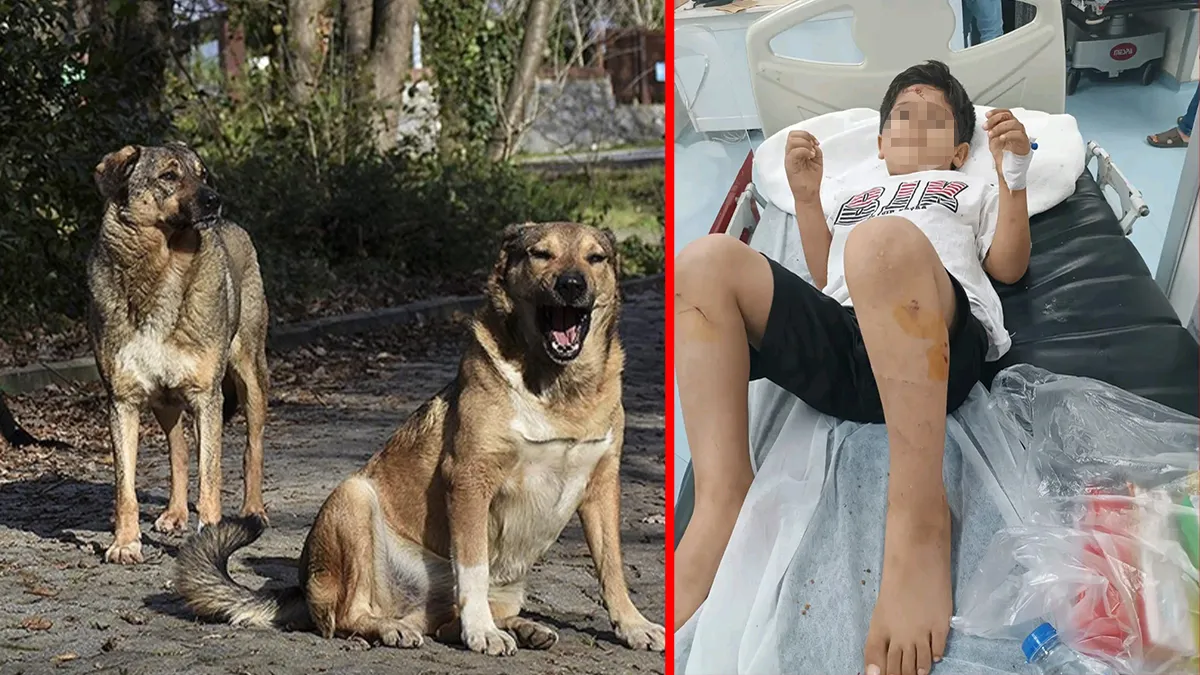 Şanlıurfa’da korkunç olay! Başıboş sokak köpeklerinin saldırısına uğradı: Minik Abdulkadir yaralandı! Şanlıurfa’da korkunç olay! Başıboş sokak köpeklerinin saldırısına uğradı: Minik Abdulkadir yaralandı!