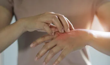 Yaz hastalıklarına dikkat!