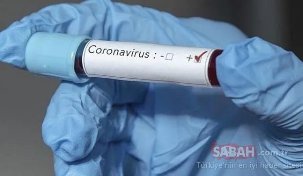 Son dakika: Corona virüsü Türkiye’ye de sıçradı! İsrail’den bomba iddia geldi! Koronavirüsün aşısı bulundu mu?