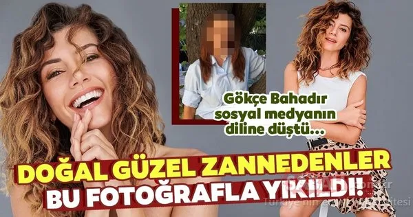 yaprak dokumu nun leyla si gokce bahadir i dogal guzel zannedenler bu fotografla yikildi iste gokce bahadir in estetiksiz hali galeri magazin
