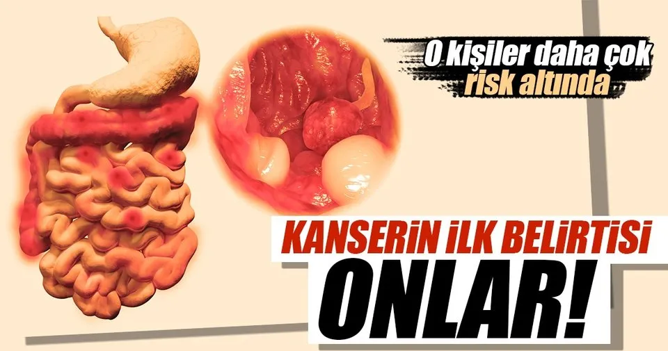 bagirsakta polip olusumuna etki eden en