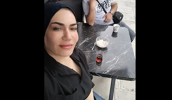bakim-merkezinde-burnu-kirilinca-hayati-kabusa-dondu-4-yilda-tam-4-kez-bicak-altina-yatti-hem-yandi-hem-yirtil-1787137455379.jpg