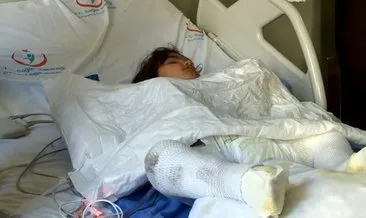 Ekmek tandırına düşen küçük Fatma Nur yanarak yaralandı