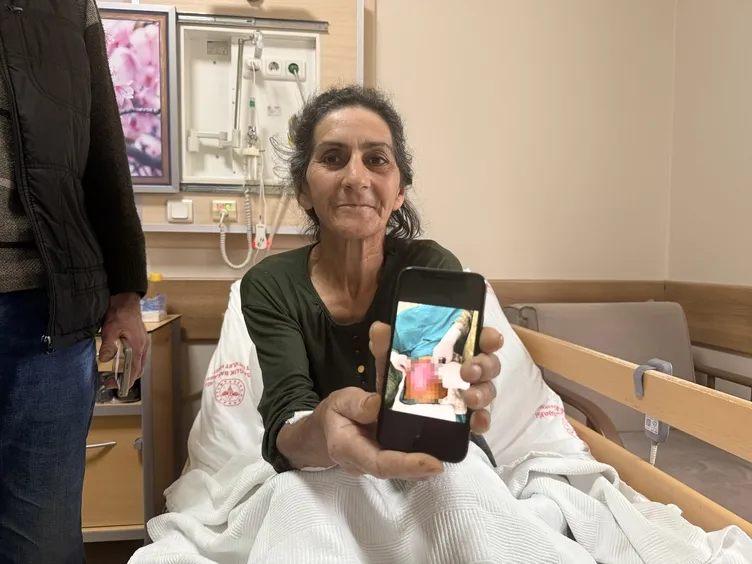 Karın ağrısı şikayetiyle hastaneye gitti! Karnından öyle bir şey çıktı ki! Tam 6 kilo!