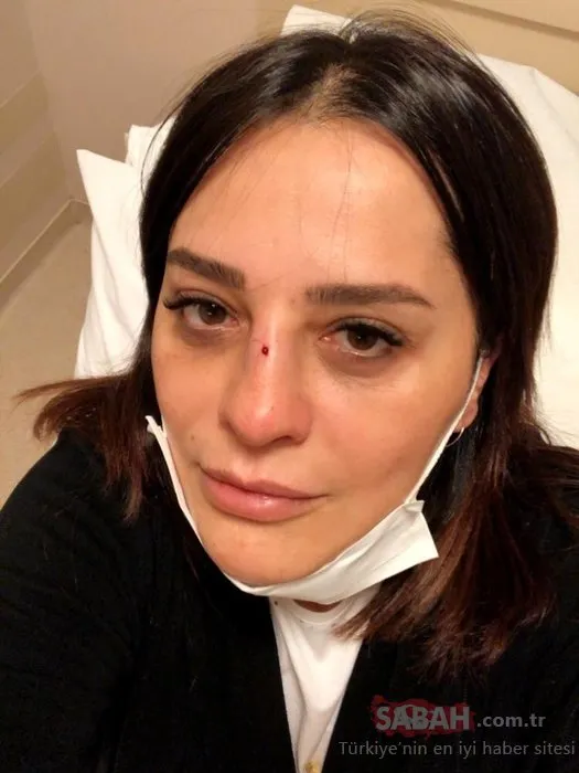 Ünlü şarkıcı Reyhan Karaca’nın talihsiz kazada burnu kırıldı!