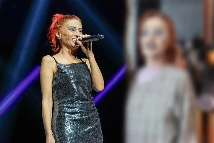 Saç boyası yüzünü yakmıştı! Yıldız Tilbe şimdi de yüzündeki beneklerle gündem oldu...