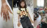 Son dakika: Türkiye Bursa’da çöp evde bulunan çocuğu konuşuyor! Muhammed’in ilk sözleri bu olmuş!