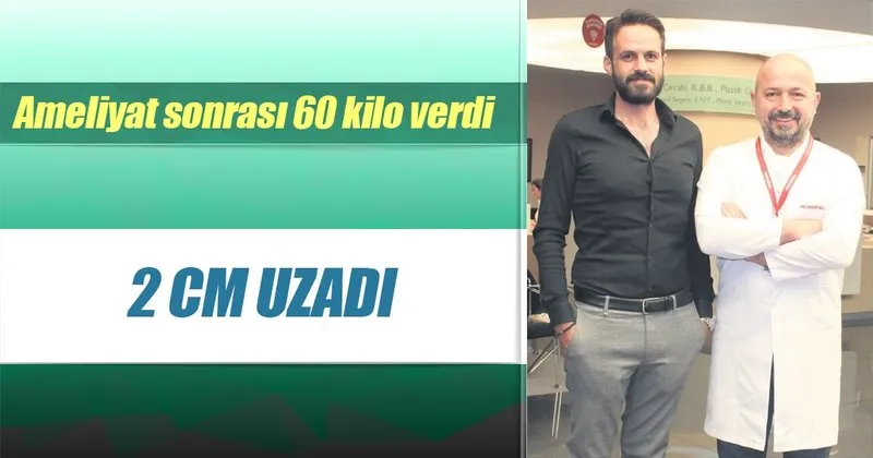 60 Kilo Verdi 2 Cm Uzadi Saglik Haberleri