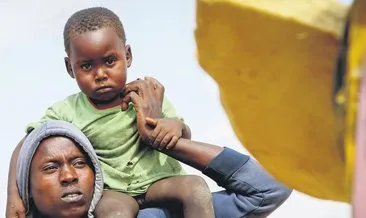 Somali’de 200 çocuk yetersiz beslenme nedeniyle öldü