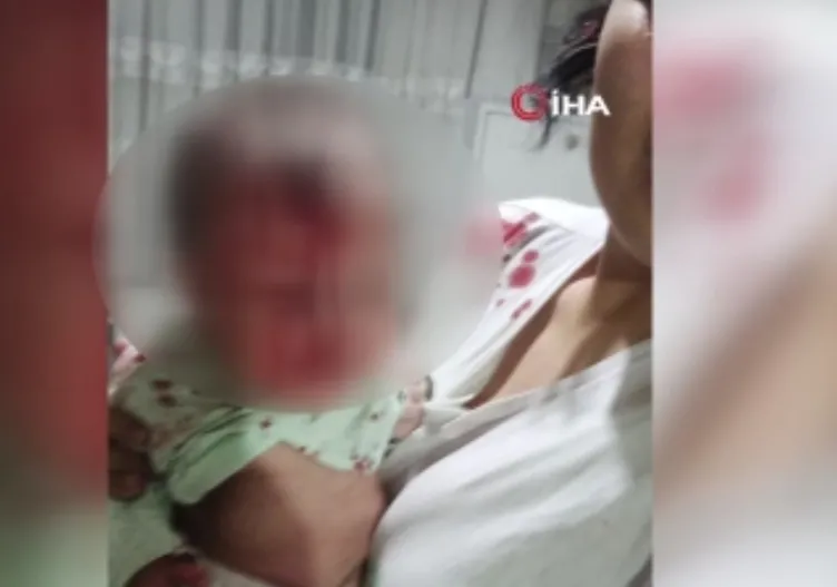 Bu nasıl baba? Bebeği kanlar içinde kaldı! Görüntüler ortaya çıktı: 2 iddia var!