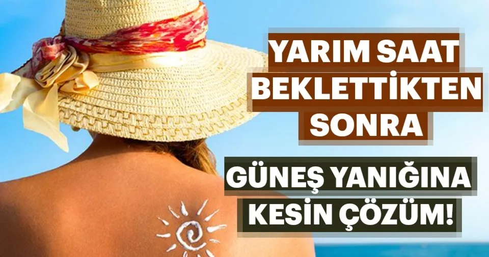 Gunes Yanigina Kesin Cozum Saglik Haberleri