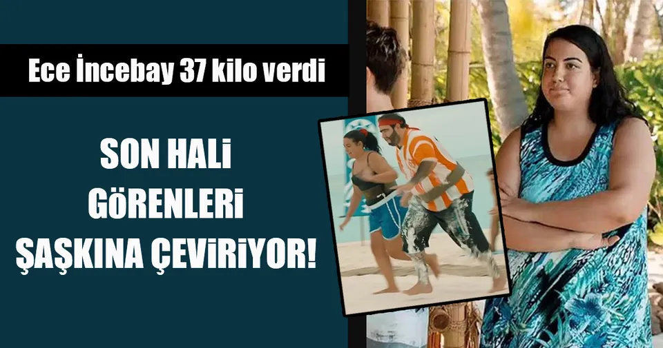 Ece İncebay�ın son hali şaşkına çevirdi Son Dakika Magazin Haberleri