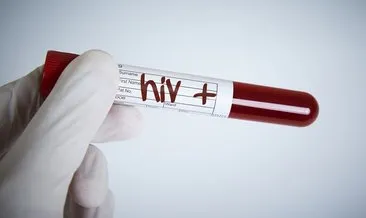 AIDS Tedavi Edilir Mi? AIDS HIV Tedavisi Var Mı, Tamamen Düzelir Mi?