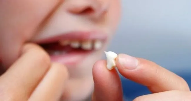 ruyada dis dokulmesi nedir ne anlama gelir ruyada dis kirilmasi cikmasi dusmesi tabiri son dakika haberler