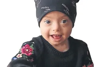 Lösemi hastası Afra’dan iyi haber