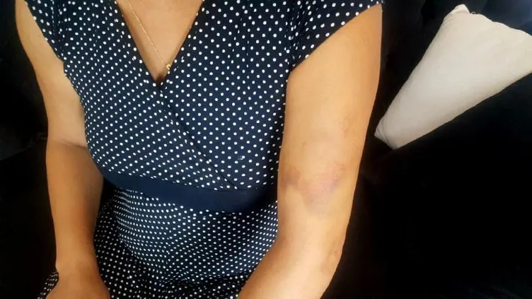 Genç kadına güpegündüz dehşeti yaşattı