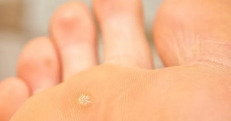 Ayak Nasiri Nasil Olur