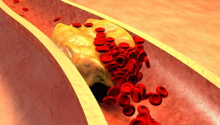 Kolesterolü bitiren besin! 1 kaşık tüketmek tıkalı damarları anında açıyor...