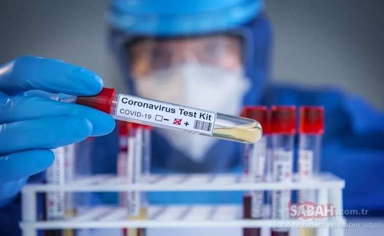 Sahte koronavirüsü test sonuçları dehşet saçıyor! Uzmanlar uyardı aman dikkat!