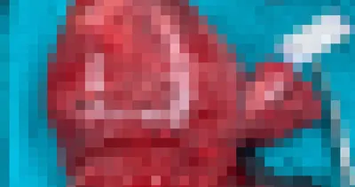 Kadın hastanın karnından çıktı! Doktorlar gözlerine inanamadı