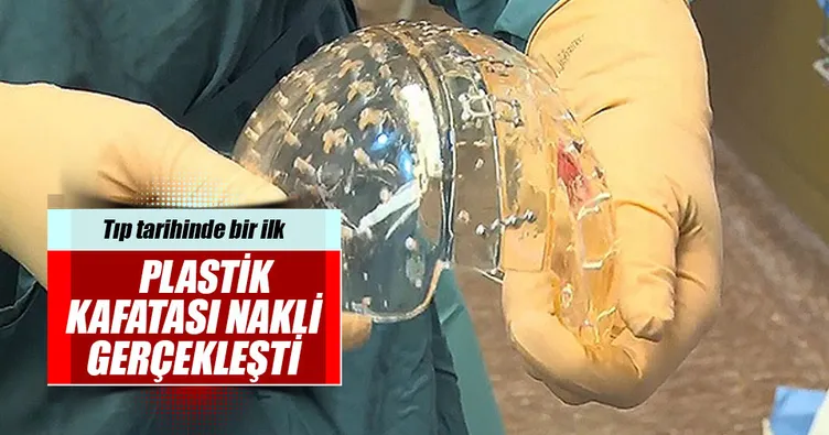 Tıp tarihinde bir ilk: Plastik kafatası nakli
